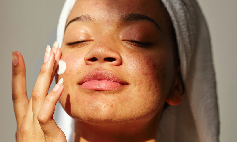 woman applying cream to her face